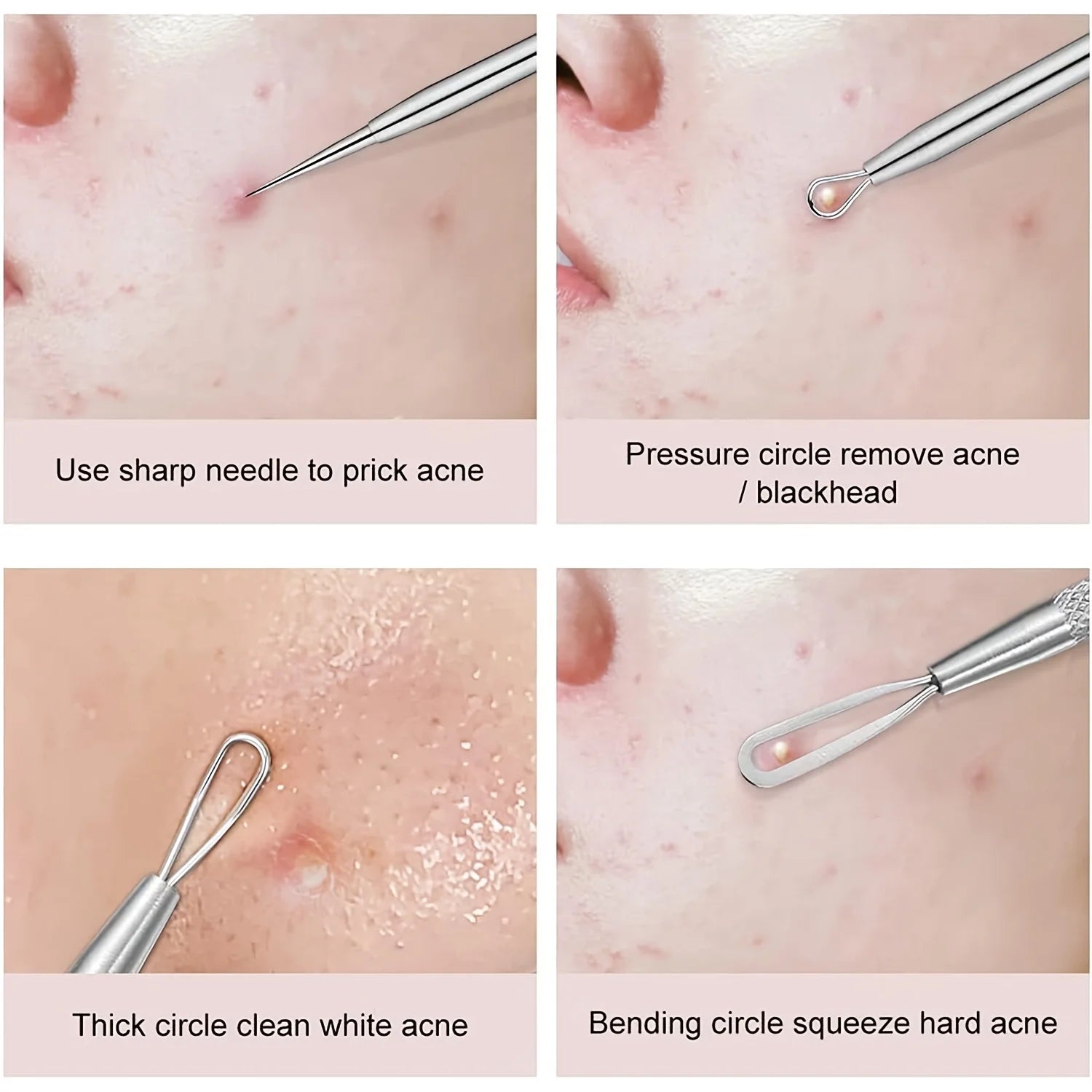 PuhMaxx Acne Blackhead Tweezers
