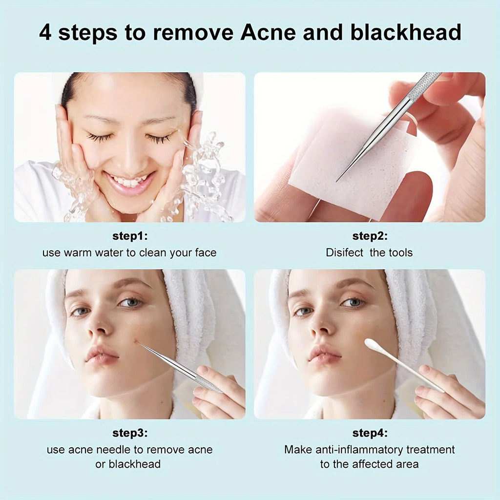 PuhMaxx Acne Blackhead Tweezers